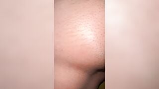 Bướm mới triệt lông ae ơi phần 1